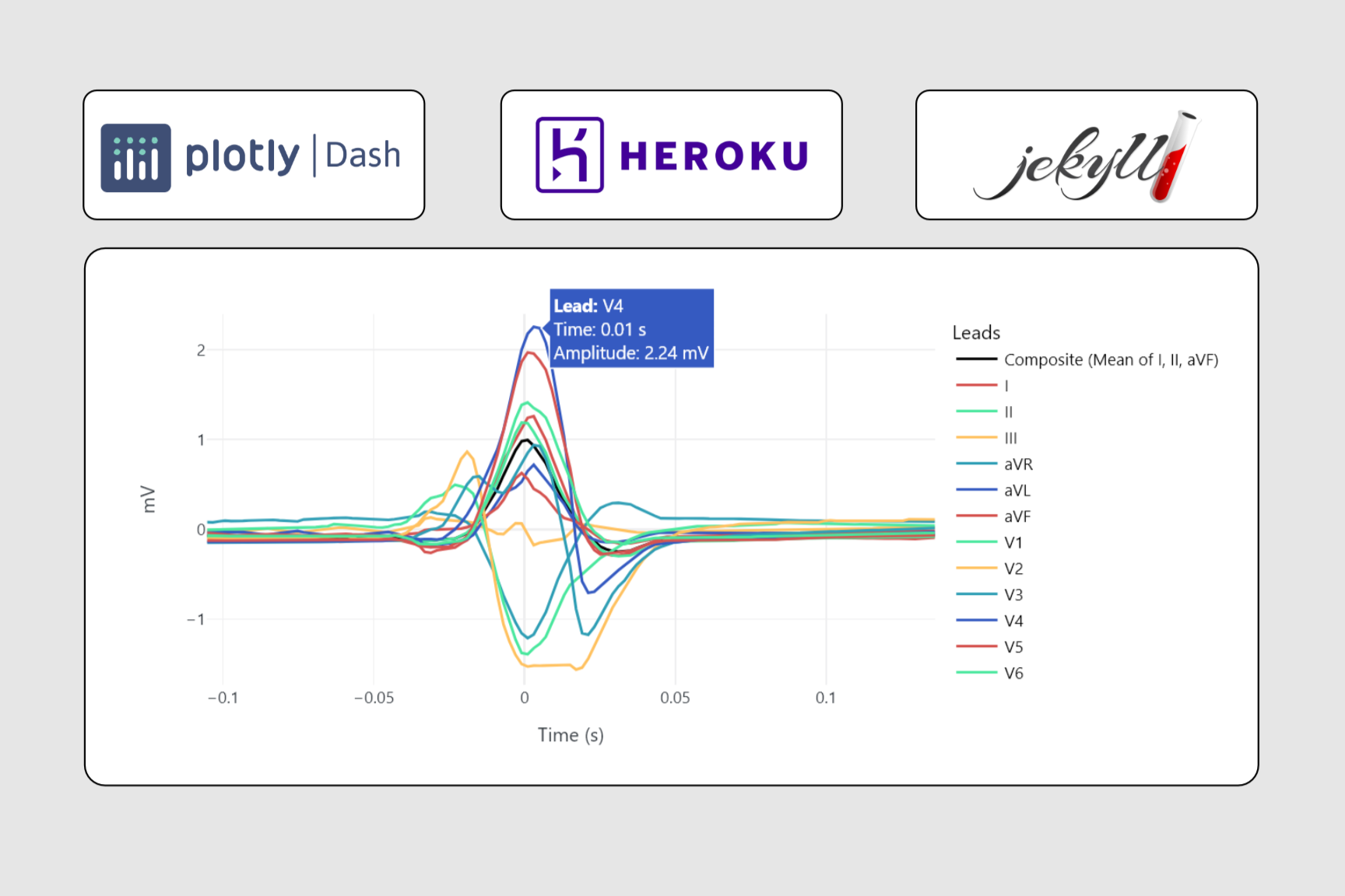 QRS Complex Labeling in ECG Data Using Plotly Dash